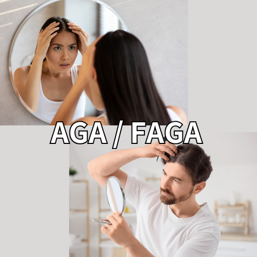 AGA、FAGA