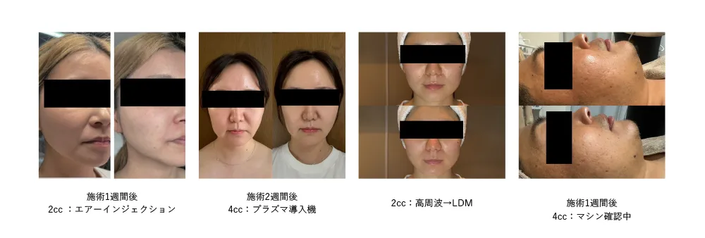 BeforeAfter1
