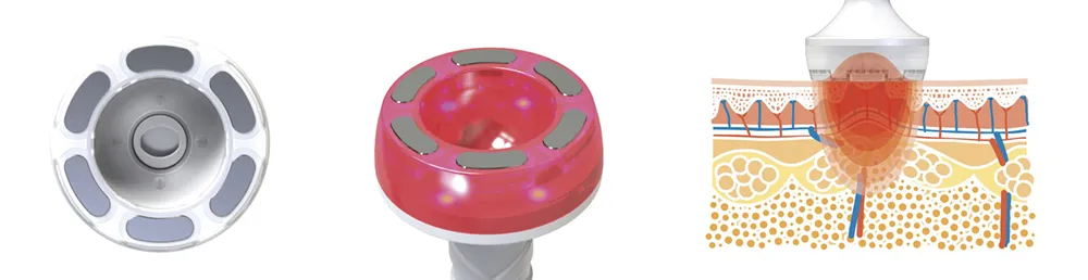 セルチューン画像1