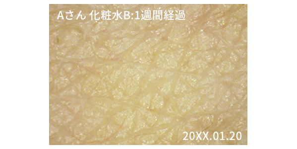 静止画・動画の保存