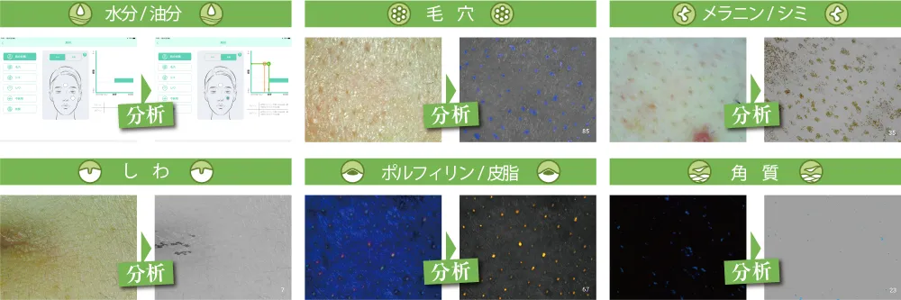 蓄積された膨大な肌データに基づく高精度の分析。一括分析も可能!