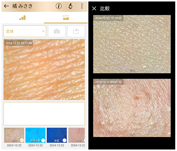 過去の撮影画像は一覧で表示することができ、そこから画像のみでの比較も可能です。