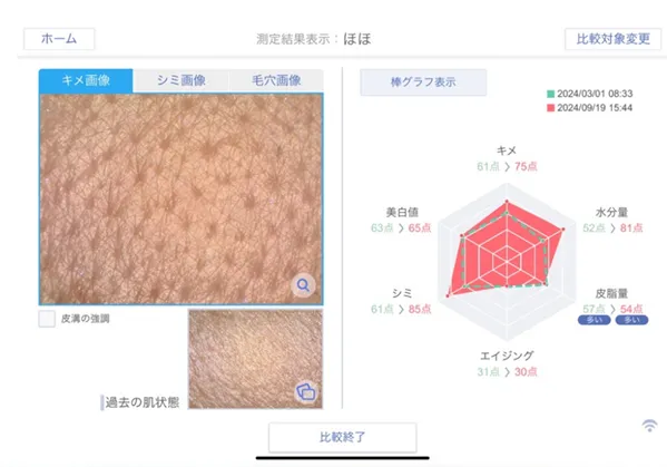 スマートスキンケア5
