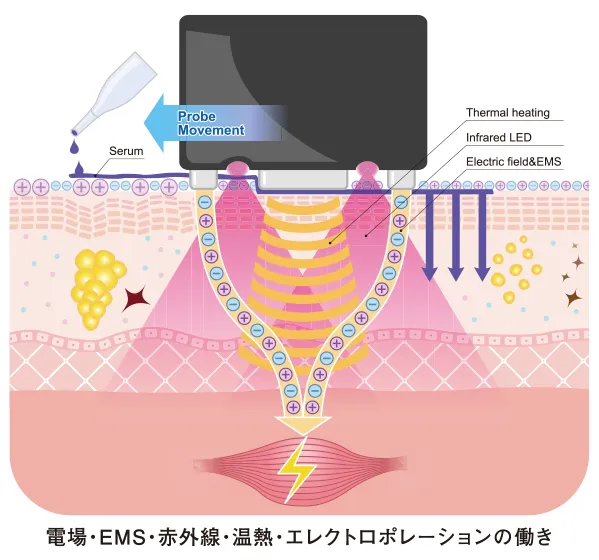 EMS・赤外線・温熱・エレクトロポレーションの働き