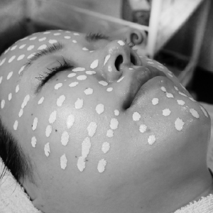 メソスキンカラー導入をするなら今！？