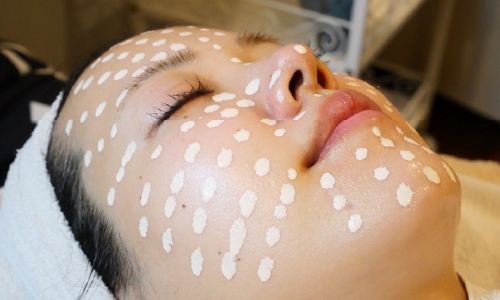 メソスキンカラー