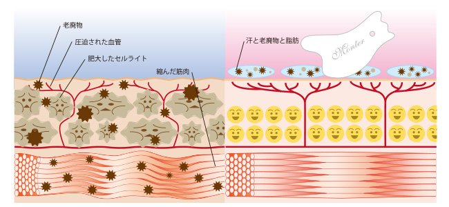 カッサの仕組み