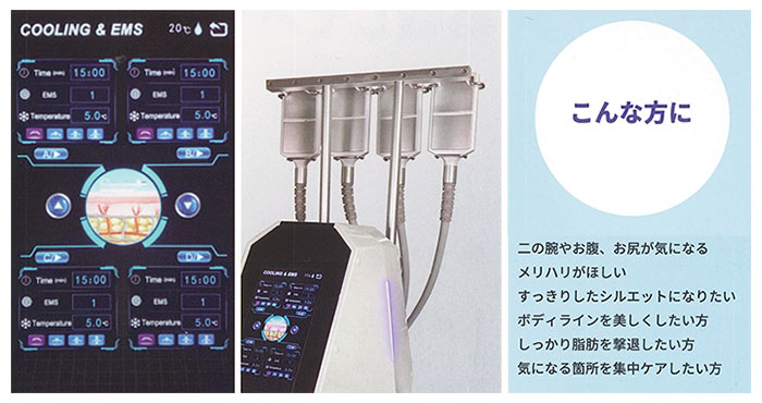 こんな方に。二の腕やお腹、お尻が気になる。メリハリが欲しい。スッキリしたシルエットになりたい。