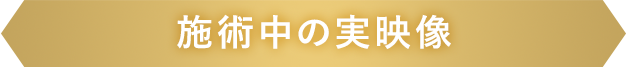施術中の実映像