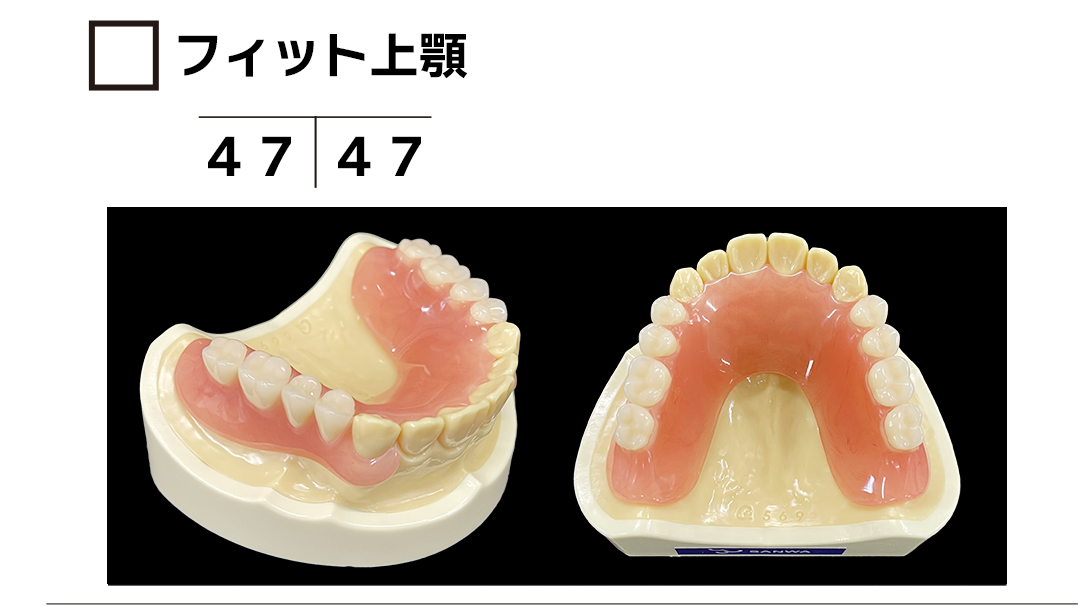 ｻﾝﾌﾟﾙ　フィット上顎