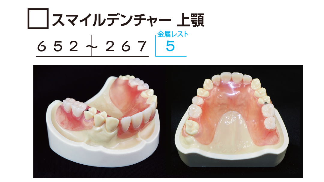 ｻﾝﾌﾟﾙ　ｽﾏｲﾙﾃﾞﾝﾁｬｰ上顎