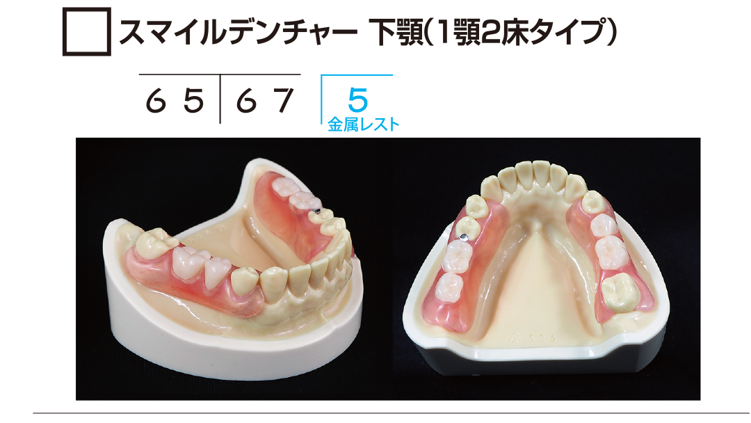 ｻﾝﾌﾟﾙ　ｽﾏｲﾙﾃﾞﾝﾁｬｰ下顎 (1顎2床ﾀｲﾌﾟ)