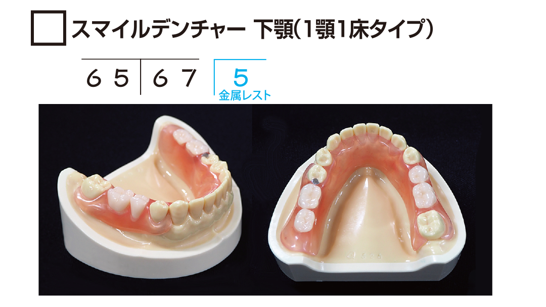 ｻﾝﾌﾟﾙ　ｽﾏｲﾙﾃﾞﾝﾁｬｰ下顎(1顎1床ﾀｲﾌﾟ)