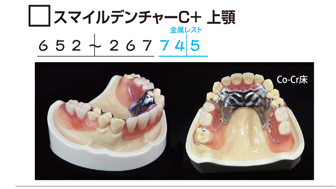 ｻﾝﾌﾟﾙ　ｽﾏｲﾙﾃﾞﾝﾁｬｰCﾌﾟﾗｽ上顎