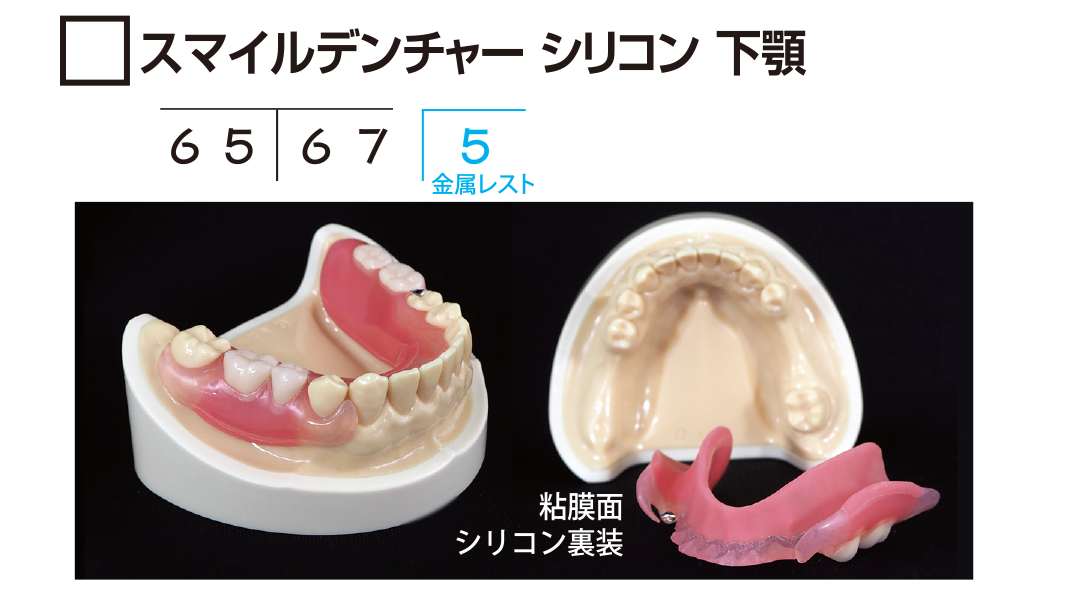 ｻﾝﾌﾟﾙ SD ｼﾘｺﾝ ｽﾀﾝﾀﾞｰﾄﾞ　（※下顎）