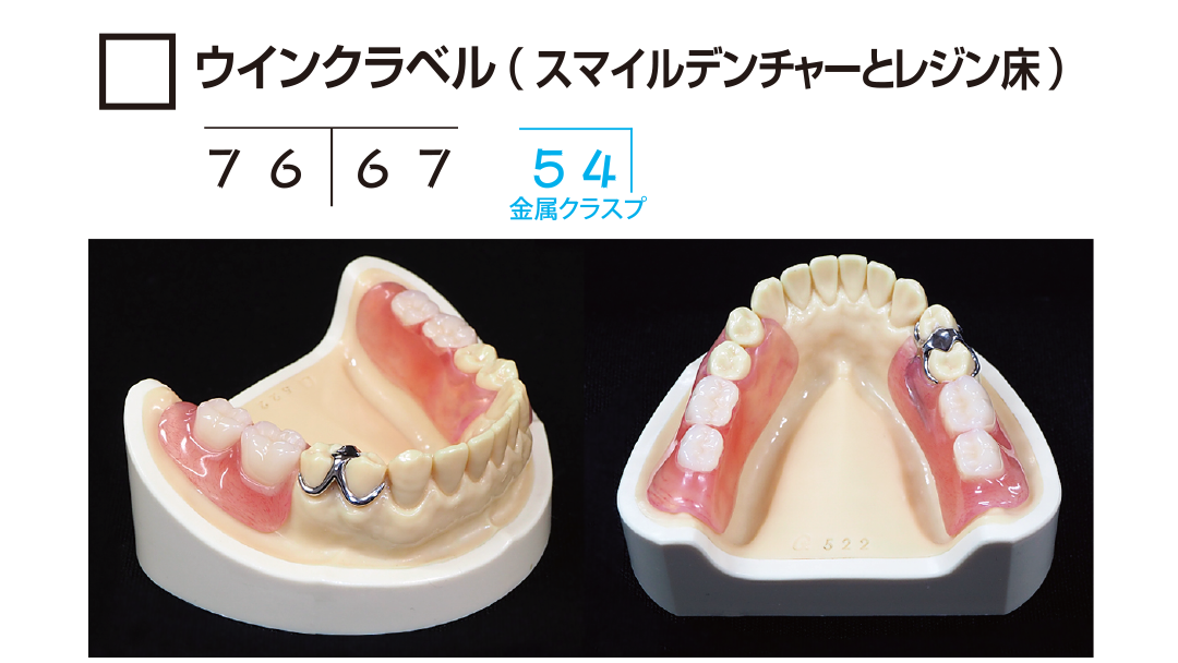 ｻﾝﾌﾟﾙ　ｳｨﾝｸﾗﾍﾞﾙ