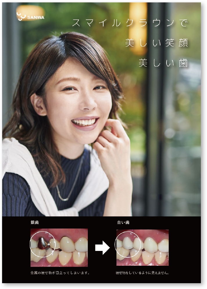 スマイルクラウン・女性タイプ