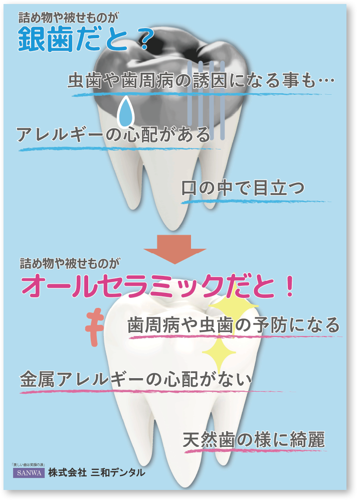 スマイルクラウン・銀歯だと？